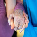 What is considered an episode of care?